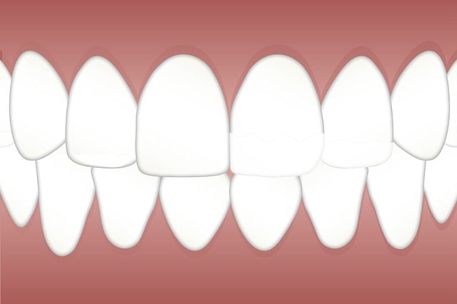 tooth bonding dentistry
