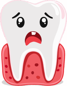 toothache-symptoms-640x480-47270103.png