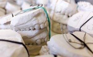 wisdom-teeth-dentistry-640x480-71239829.jpeg