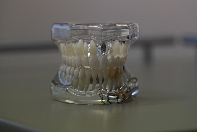 dentures dentistry