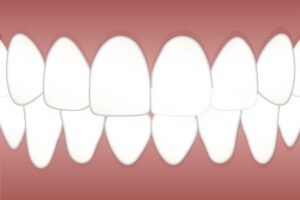 endodontics-dentistry-640x480-16136068.jpeg