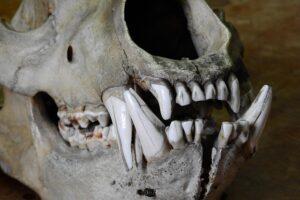 jaw-pain-blog-640x480-95635560.jpeg
