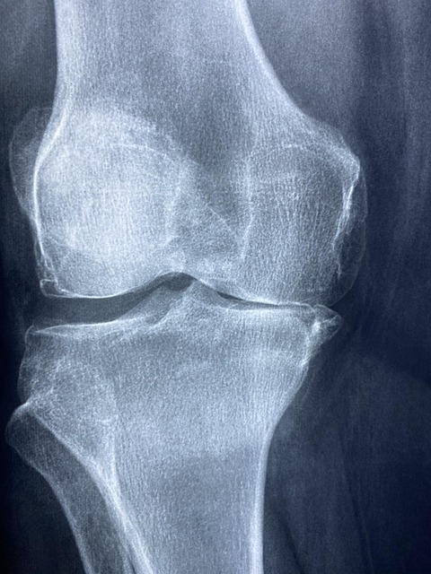 malpractice injuries