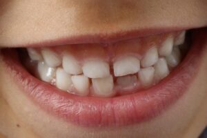 oral-rehabilitation-640x480-42453380.jpeg