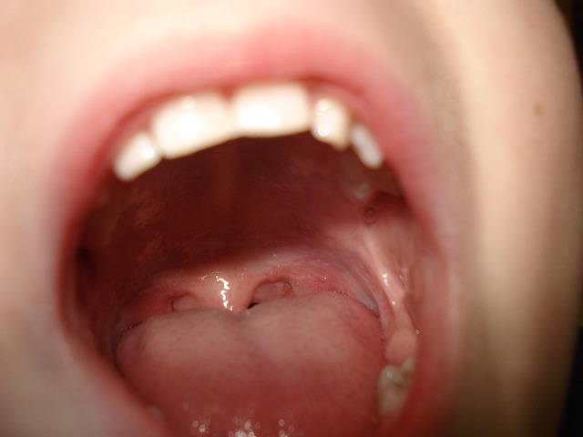 oral surgery