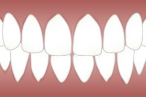 periodontics-dentistry-640x480-59931466.jpeg