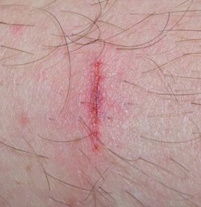 personal-injury-law-640x480-20046052.jpeg