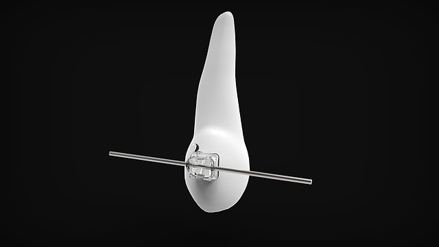 teeth grinding solutions