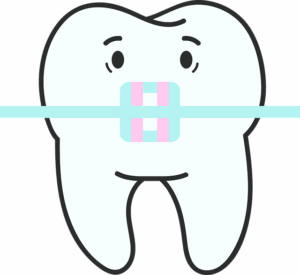 tooth-braces-640x480-11874717.png