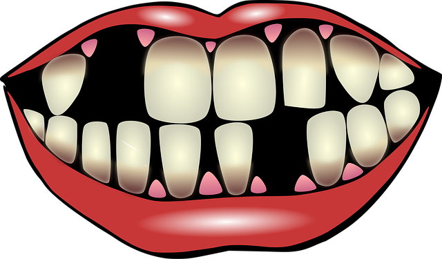 tooth replacement