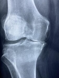 boating-injuries-640x480-30671196.jpeg