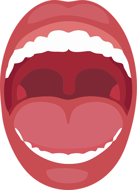 dental bridges