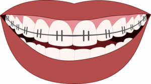 dental-checkups-640x480-93711742.png