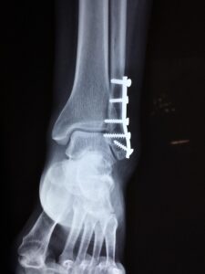 medical-malpractice-injuries-640x480-21771823.jpeg