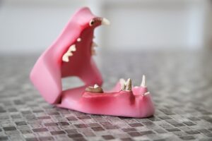 orthodontics-dentistry-640x480-88934914.jpeg