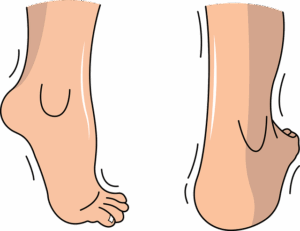 personal-injury-640x480-83976578.png