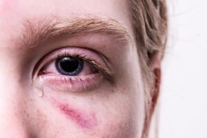 personal-injury-law-640x480-29031593.jpeg