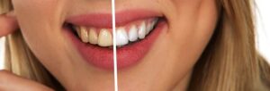 restorative-dentistry-640x480-96035407.jpeg