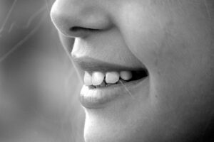 teeth-whitening-640x480-17085038.jpeg