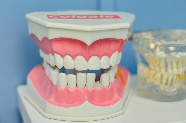 teeth whitening