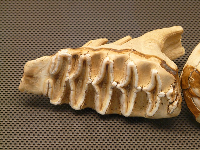 tooth-braces-640x480-53513005.jpeg