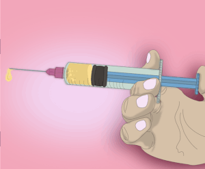 cavity-prevention-blog-640x480-73939707.png