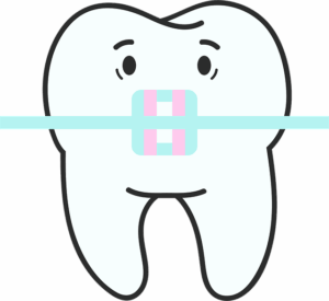 orthodontics-dentistry-640x480-27879461.png