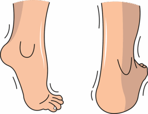 personal-injury-law-640x480-95593421.png