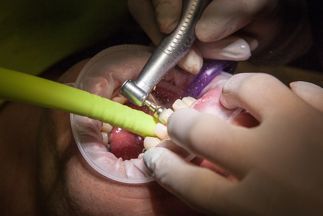 teeth grinding solutions