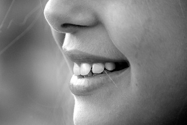 teeth whitening