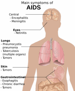 toothache-symptoms-640x480-92085982.png