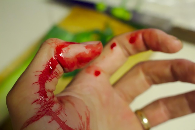 malpractice-injuries-640x480-62851981.jpeg
