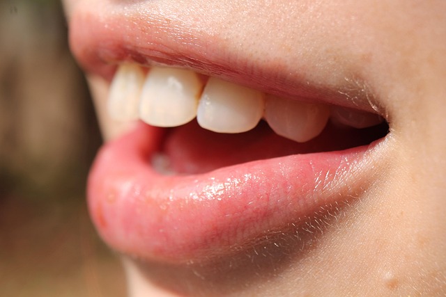 oral cancer