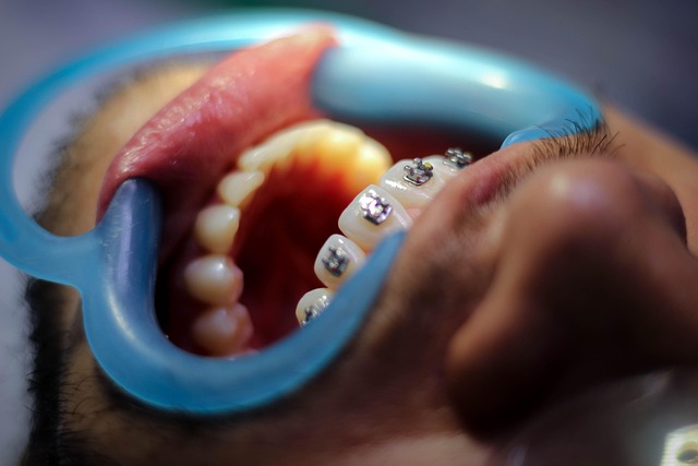 orthodontics dentistry