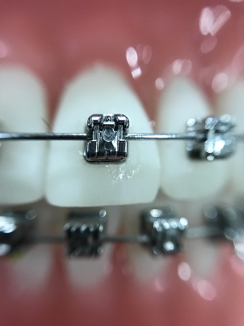 orthodontics dentistry