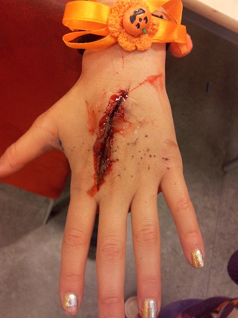 premises injury