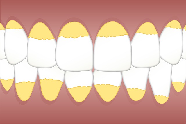 prosthodontics dentistry