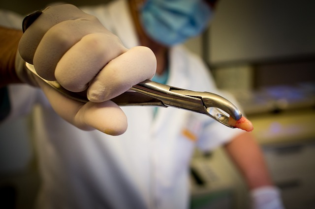 tooth bonding dentistry