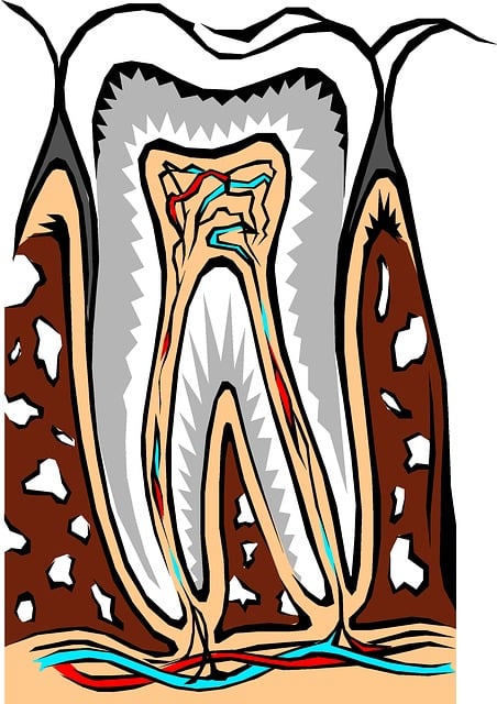 tooth extractions