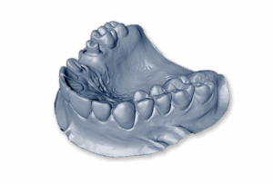 tooth-extractions-640x480-57549198.png