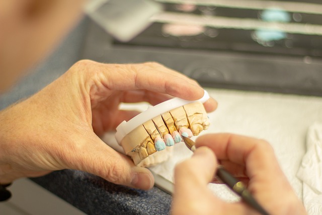 veneers
