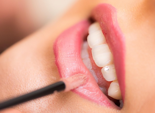 dental checkups