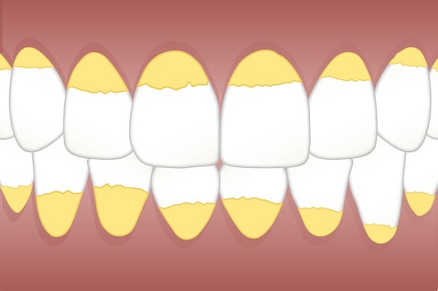 Unveiling Optimal Dental Health: The Power of Cleaning