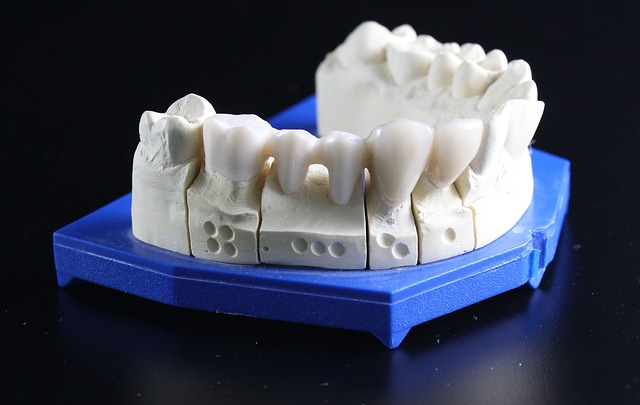 dental implants