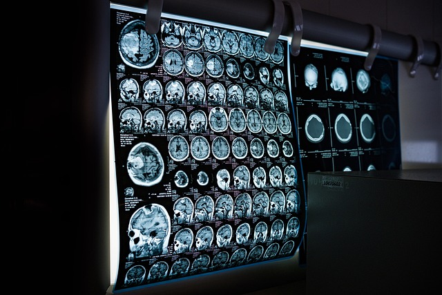 Fight for Justice: Medical Malpractice Personal Injuries Compensation