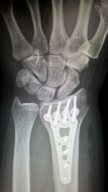 oral-surgery-640x480-42313870.jpeg