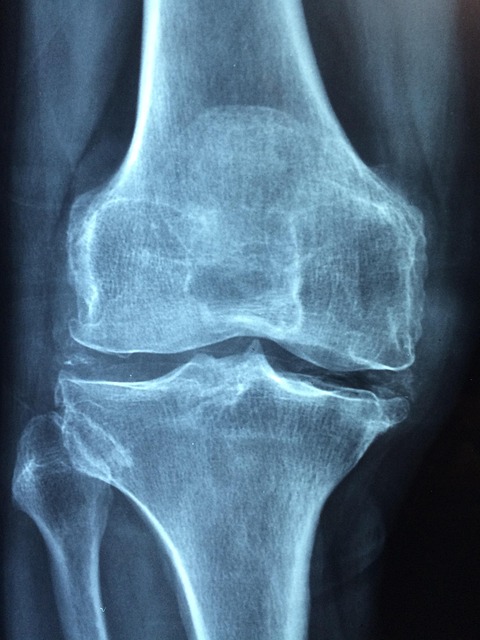 Personal Injury