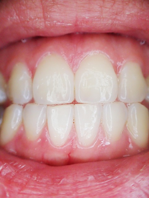 tooth-bonding-dentistry-640x480-15848752.jpeg
