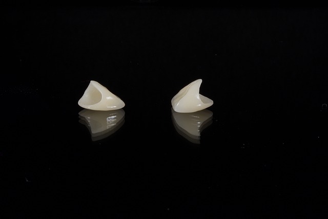 tooth bonding dentistry
