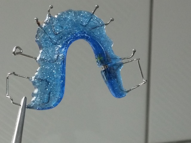 tooth braces